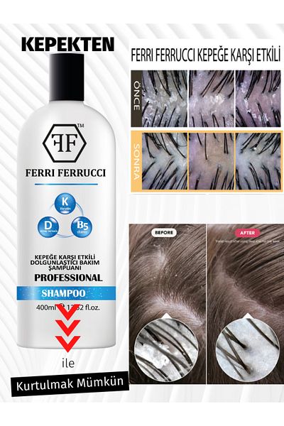 Ferri Ferrucci Dandruff Shampoo - Soothing and Soothing Skin Anti Dandruff