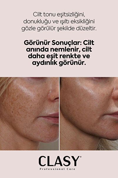 Clasy Care Cilt Beyazlatıcı Ve Cilt Tonu Eşitleyici Pigment Corrector Krem (WHİTENİNG)