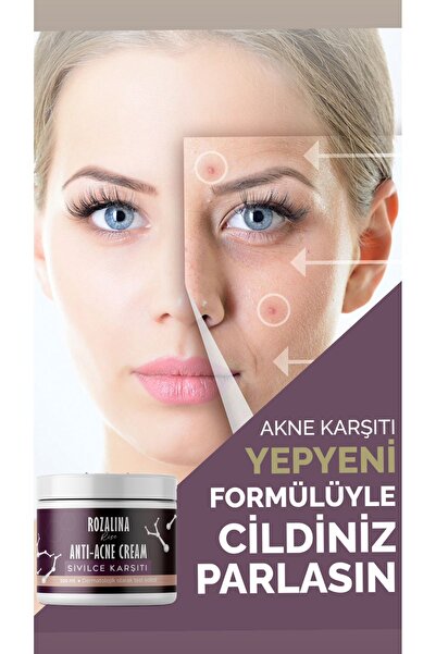 Rozalina Rise Sivilce1 giderici Kurutucu Ve Karşıtı, Akne, Siyah Nokta Leke,g...