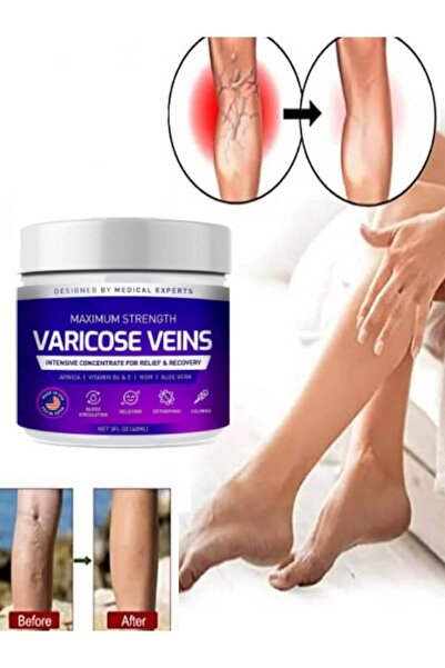 HİNTOHU Varicose Veins Purple Krem Bacak Bakımı Kremi 100 ml x 1 ad
