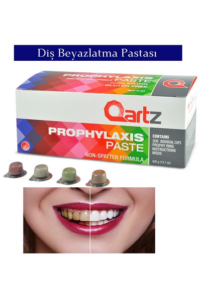 qartz Teeth Whitening and Polishing Paste 30 Pieces