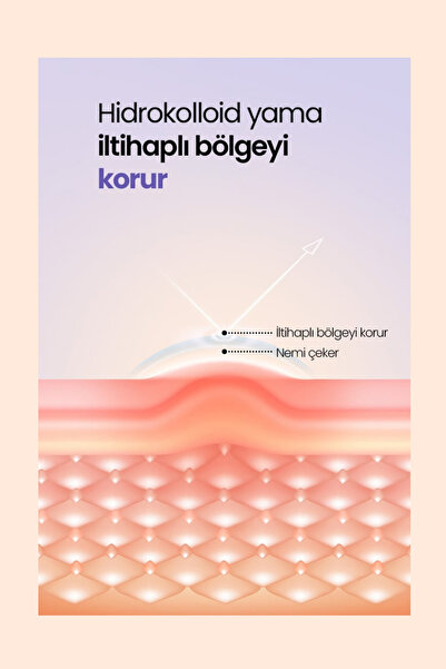 bloomplus Bakım Bandı Pimple Patch 72 Patch Sos Band BPHZT079