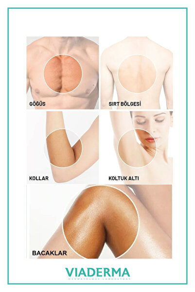 Viaderma Hassas Ciltler İçin Epilasyon Kremi 150 ml - Tüm Cilt Tiplerine Uygun Pratik Sprey