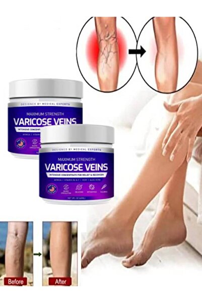 HİNTOHU Varicose Veins Purple Krem Bacak Bakımı Kremi 100 ml x 2 ad
