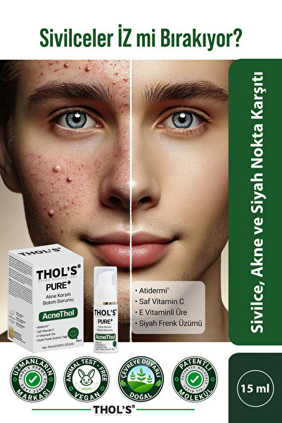 THOLS بيور أكنيثول - مصل العناية المضاد لحب الشباب والرؤوس السوداء - 15 مل