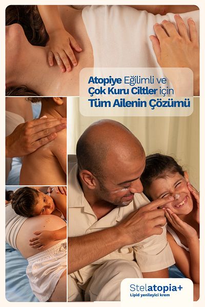 Mustela كريم مرطب عضوي معتمد من ستيلاتوبيا + للبشرة الجافة جدًا والمتأتبة للأطفال والبالغين 300 مل