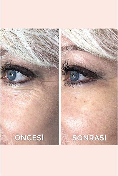 VITAYES Anlık Etkili Sıkılaştırıcı Yüz Kremi, Göz Altı Torbaları Ve Kırışıklık Karşıtı Acetyl Hexapeptide-8