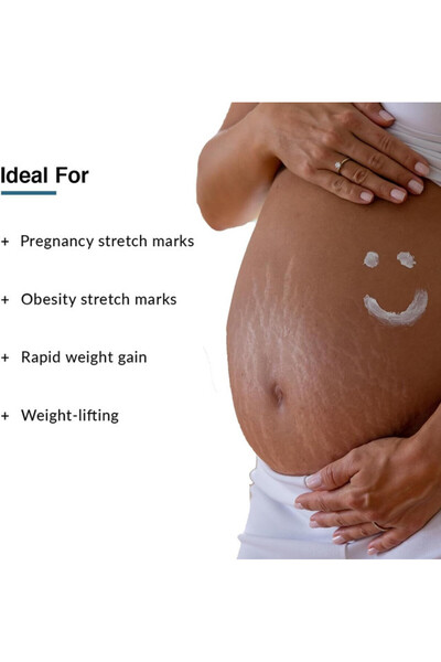 FixDerma Strallium Stretch Mark Cream, Removes Pregnancy Marks & Scars, Moisturizing, 75g.