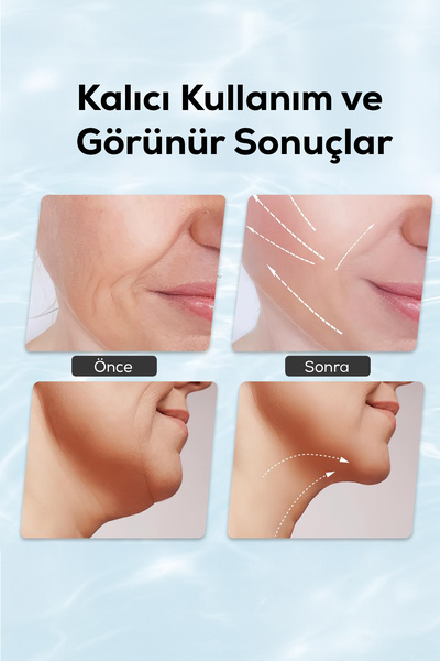 DEMPOWER Yüz ve Boyun Cilt Bakım Cihazı – EMS LED Teknolojisi ile ve Sıkılaştırıcı
