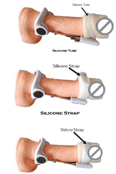 Byanes Ex System Kit Ve Pompa & Özel Krem