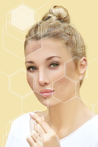 serena beauty Salon Size Lactic Acid 10% - Professional Treatment - 100 ml