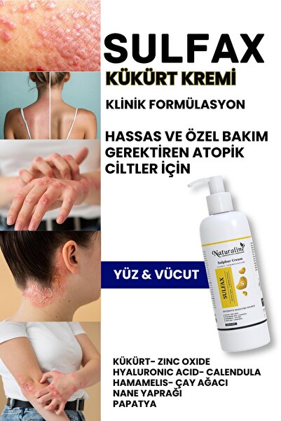 Naturaline Professional Kükürtlü Sulfax Lekeli Cilt & Egzamaya Karşı Krem 100 ml