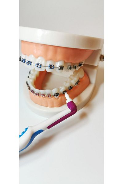 Pearldent Interdental Set