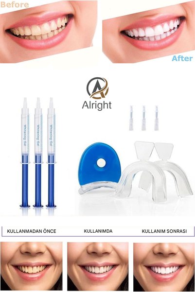 Alright Hızlı Etkili Diş Beyazlatma Seti Aktif Diş Beyazlatma Cihazı ve Şırınga Seti (teeth whitening)