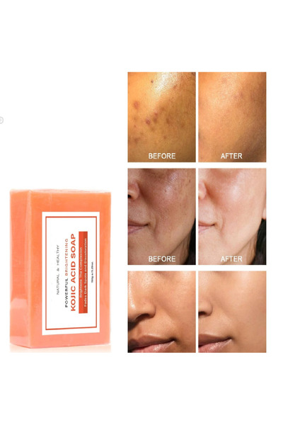 VERANT Turmeric and Kojic Acid Effective Anti-Blemish Kojic Acid Soap