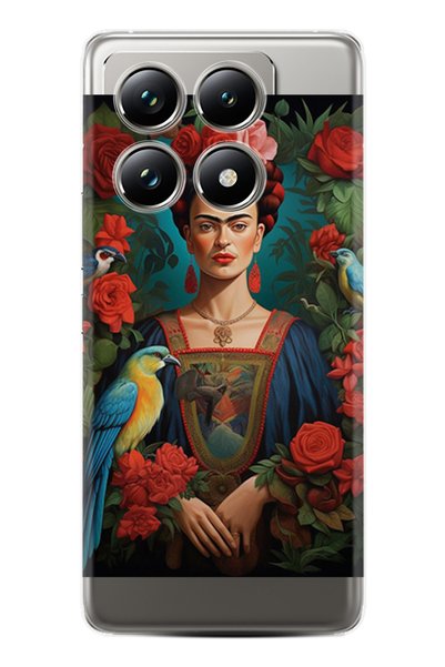 Arvencase حافظة Poco X6 Pro متوافقة مع الكاميرا المطبوعة عالية الدقة ومحمية ب...