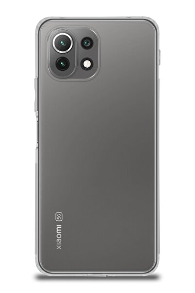 CaseWorld Xiaomi Mi 11 Lite Silikon Kılıf Kamera Korumalı Tıpalı Şeffaf Kapak