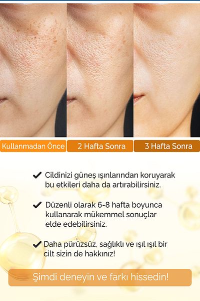 Devida Vitamin C Serum - Citéra Series A240 Breakage Tone Equalizer with Girdle