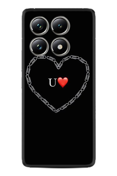 Arvencase حافظة Poco X6 Pro متوافقة مع الكاميرا المطبوعة عالية الدقة ومحمية م...