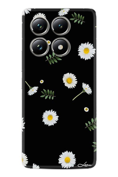 Arvencase حافظة Poco X6 Pro متوافقة مع الكاميرا المطبوعة عالية الدقة ومحمية م...