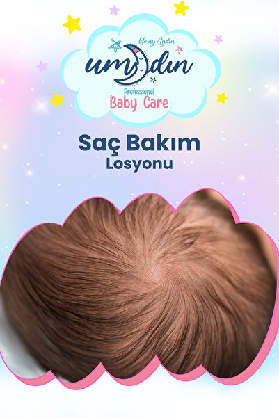 Naturaren Umay Aydın Saç Bakım Konak - Kuruluk - Dermatit Losyonu 150 ML