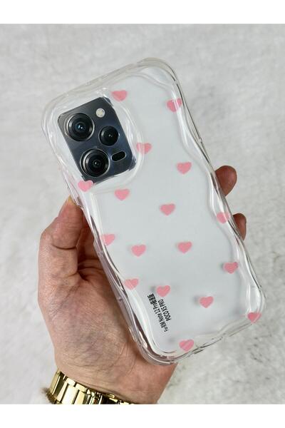 Vip Case Redmi Note 12 Pro 5G - Şeffaf Sağlam Darbe Emici Kamera Çıkıntılı Mi...