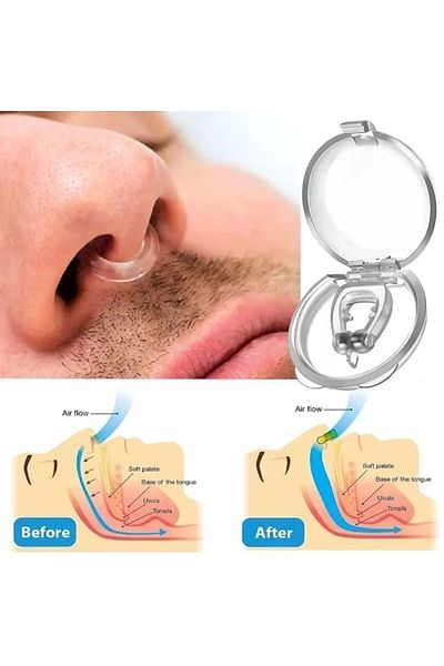 Vivaverse 6Pcs Silicone Nose Anti-Snoring Kit - Ensures Easy Breathing