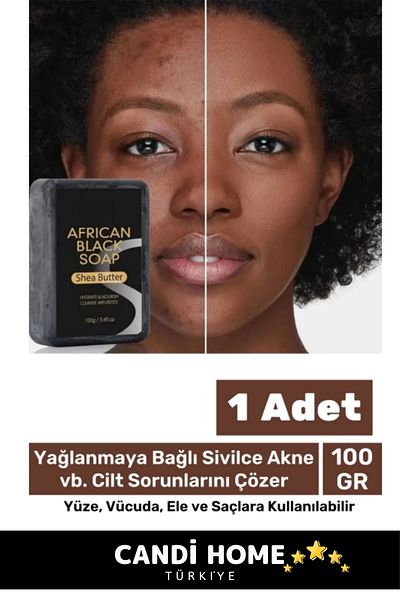 HOBİ CONDİ Special Series Natural Beautiful Fragrant Hand Face Hair Body Skin Repairing Collagen Effective African Herbal Soap
