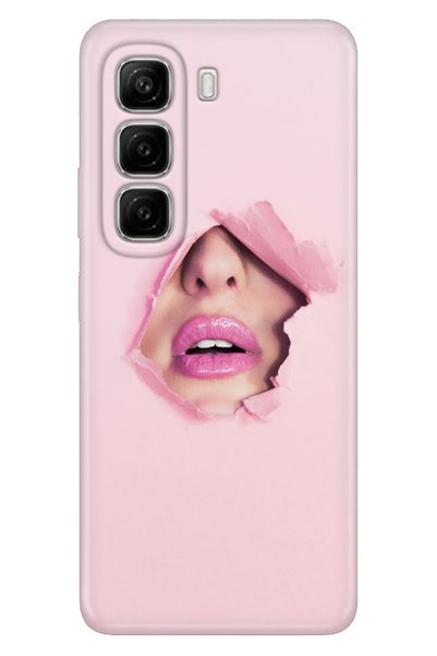 Cekuonline Infinix Hot 50 4g Case Hot 50 Patterned Tpu Silicone Hidden Love