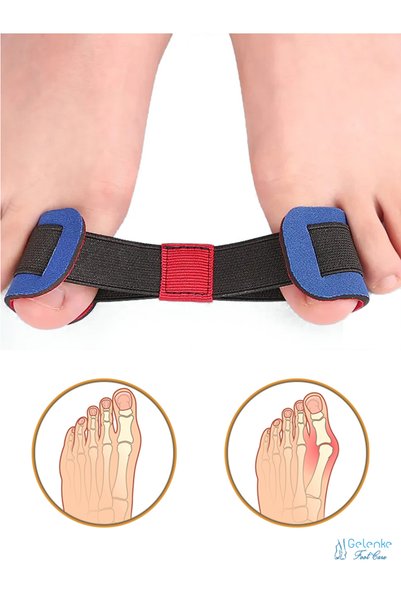 Gelenke Hallux Valgus Set of 3 - Toe Head Finger Corrector, Bunion Protector and Exercise Rubber