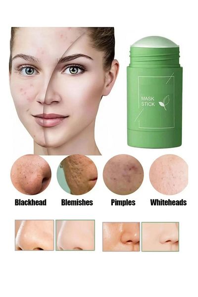 SETBEAUTY Green Tea Mask - 100% Natural Green Mask - Whitening Blackhead Mask
