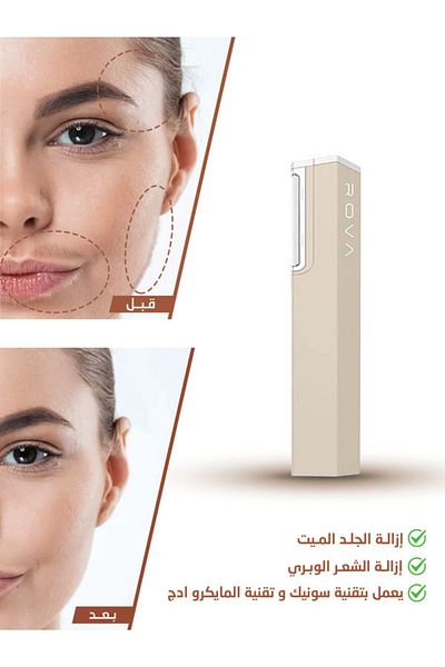 ROVA Rova hair and dead skin removal device with macro edge technology