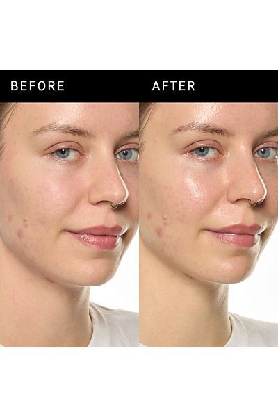 THE INKEY LIST Ectoin Hydro-Barrier Serum - Moisturizing and Protective Serum