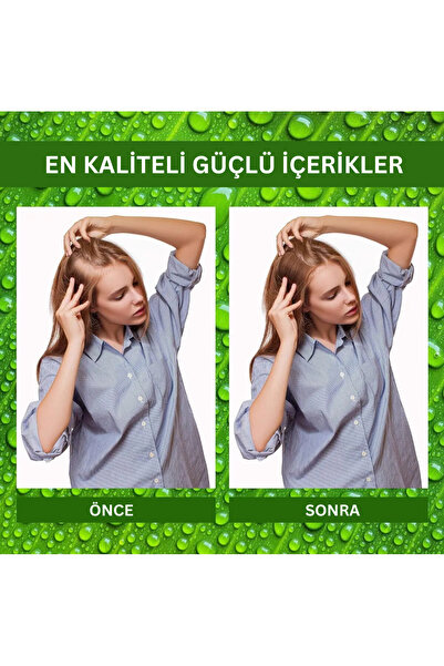 EssyNaturals Saç Uzatma Yağı | Biotin, Kafein Ve Hint Yağı Ile Daha Dolgun Ve Uzun Saçlar Için