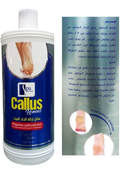 CALLUS REMOVER سائل إزالة الجلد الميت 1000 مل