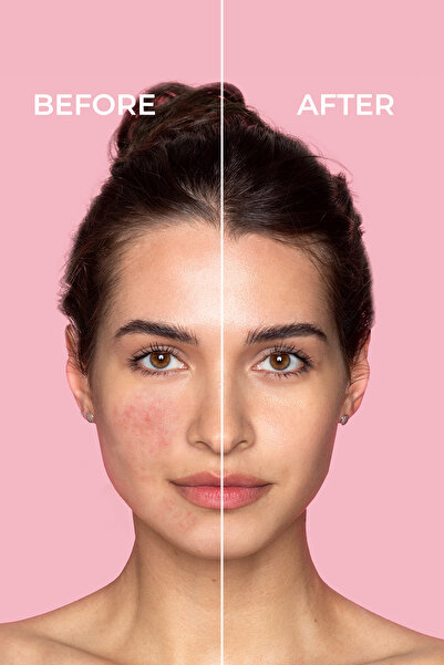 SİNOZ Pure Cica Tiger Grass Cremă de îngrijire reparatoare anti-roșeață 15 ML