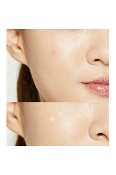 LEADING LINES COSRX Acne Patches - 24 Pieces