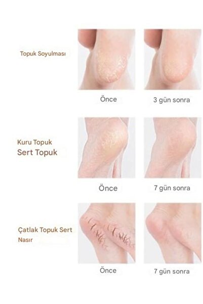 hayret sepeti Topuk Çatlaklarına Son! Silikon Nemlendirici Çorap ile Yumuşak Ayaklar