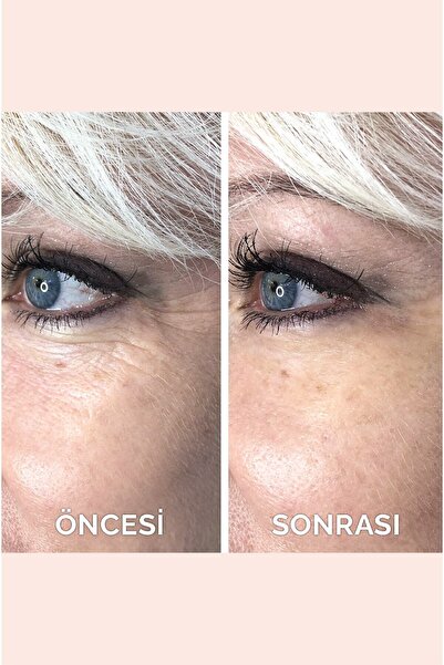 VITAYES Anlık Etkili Yüz Germe Kremi Göz Altı Torbaları Ve Kırışıklık Karşıtı %10 Acetly Hexapeptide-8