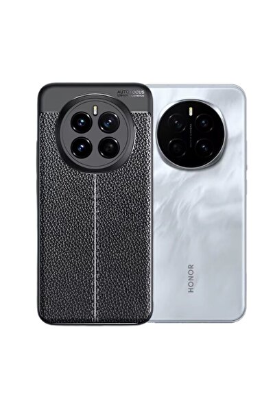HANPORIUM Honor Magic 7 Pro Uyumlu Silikon Kılıf Deri Desenli Kamera Korumalı Darbe Emici Kapak