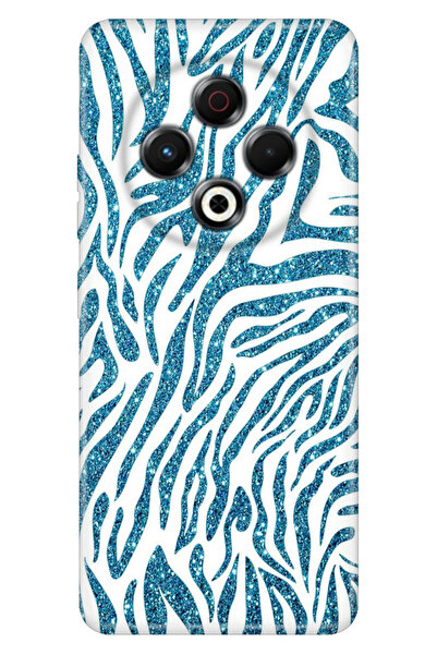 TECNO Spark 30 KL6 Kılıf Desenli TPU Silikon Parıldayan Zebra