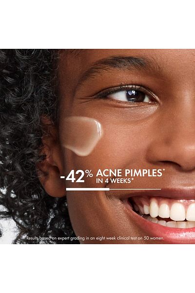 Vichy Normaderm Acne Control Moisturizer, 2% Salicylic Acid, Hyaluronic Acid, Vitamin C, Oil-Free