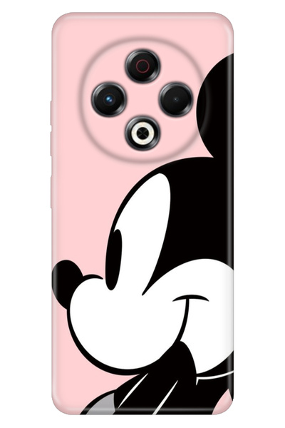 TECNO Spark 30 KL6 Kılıf Baskılı Korumalı Silikon Temalı Mickey