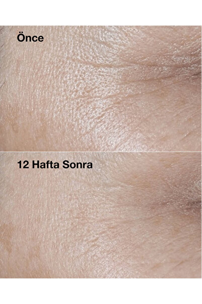 Clinique Kırışıklık Görünümü Karşıtı Smart Clinical Repair™ Spf30+ Krem 50 ML