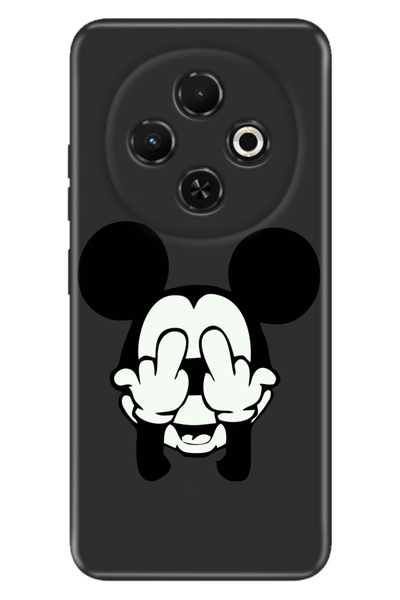TECNO Spark 30C 6.67 " Kılıf Kamera Koruma Silikon Baskılı Mickey Karakter