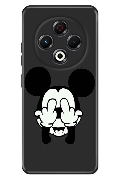 TECNO Spark 30 KL6 Kılıf Byy-78 Kamera Koruma Silikon Soyulmayan Mickey Karakter