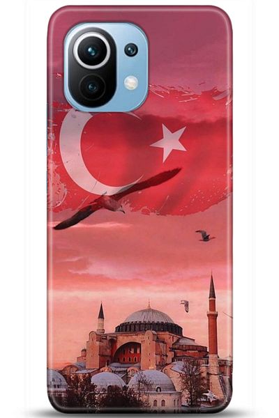 Noprin حافظة هاتف Xiaomi Mi 11 مطبوعة بدقة HD - سلسلة Loving You * 5179