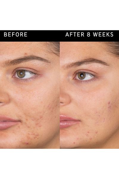 THE INKEY LIST Salicylic Acid Cleanser - Facial Cleanser