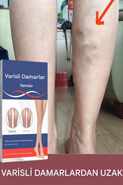 ESENLİWE 40 Adet Isı Bandı Mentol Etkili Bacak Bölgesi Hafif Orta Yoğun Kullanım