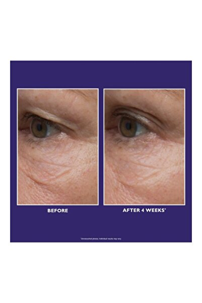 PETER THOMAS ROTH Ultimate Solution 5 Göz Kremi 15 ml